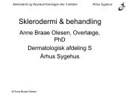 Sklerodermi & behandling - Dansk Sklerodermi & Raynaud Forening