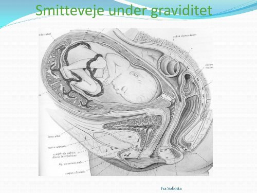 Urinvejsinfektion i graviditeten - DUGS.dk.