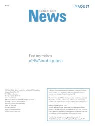 First impressions of NAVA in adult patients - Critical Care News