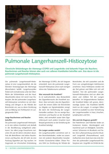 Pulmonale Langerhanszell-Histiozytose (161Kb) - CHUV