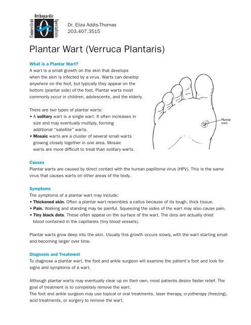 Plantar Wart (Verruca Plantaris) - CT-Ortho.com