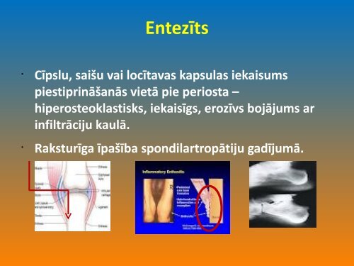 ReimatoloÄ£iska pacienta ÄrstÄÅ¡ana-komandas darbs