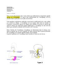 Atresie oesophage.pdf