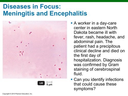 Microbial Diseases of the Nervous System