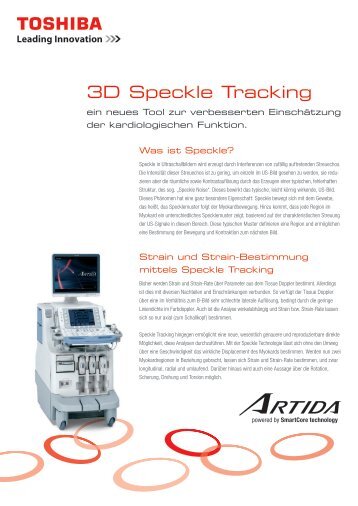 3D Speckle Tracking BroschÃ¼re - Toshiba Medical