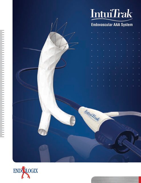 Endovascular AAA System - Endologix