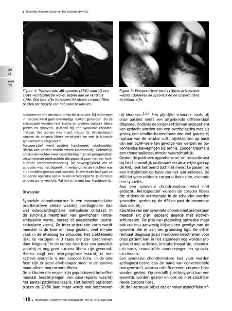 ONederlands Tijdschrift voor - Nederlands Tijdschrift voor Orthopaedie