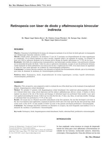 Retinopexia con láser de diodo y oftalmoscopia binocular indirecta