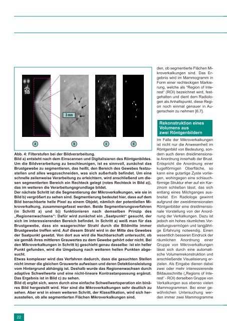 Minimal invasive Herzchirurgie - FZK