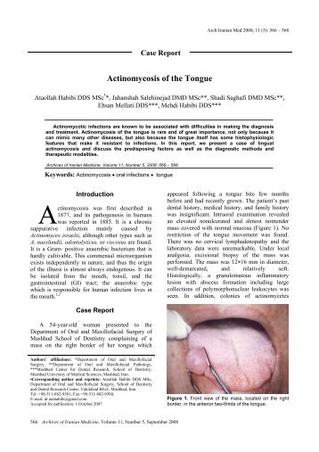 Actinomycosis of the Tongue