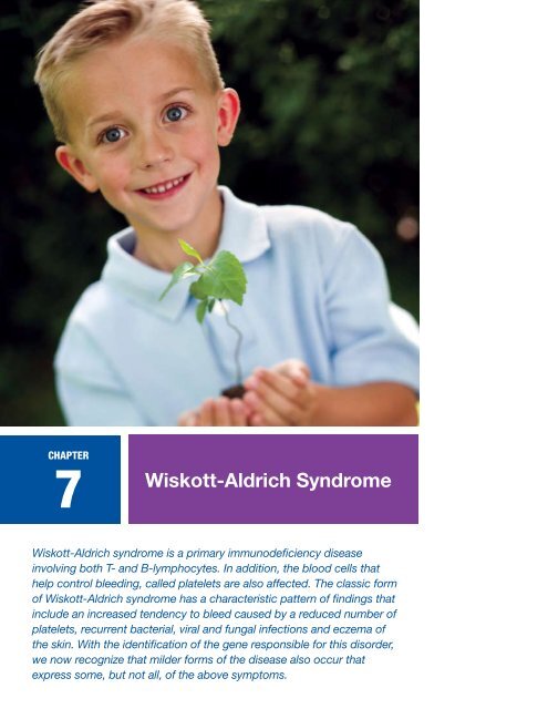 7 Wiskott-Aldrich Syndrome - Immune Deficiency Foundation