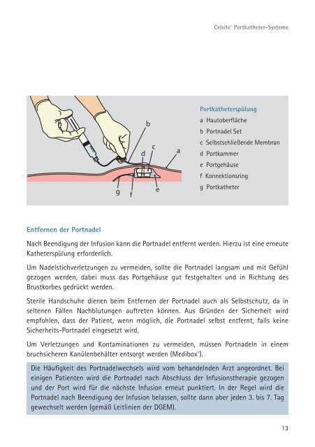 Portpunktion - HealthCare Journal - B. Braun Melsungen AG