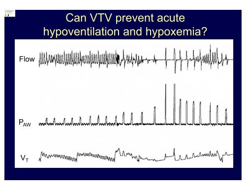 Volume Targeted Ventilation in Preterm Infants