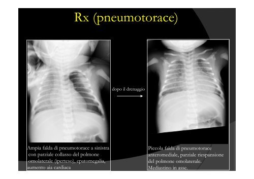 Candida per SIN [1]