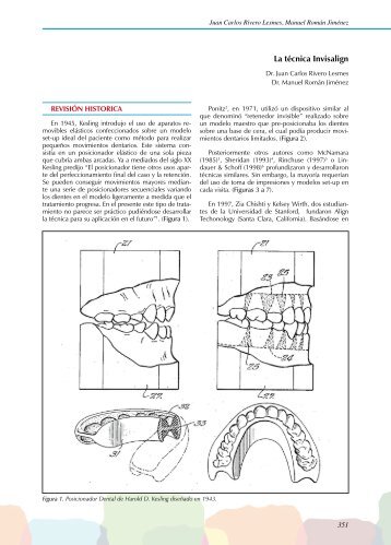 La técnica Invisalign