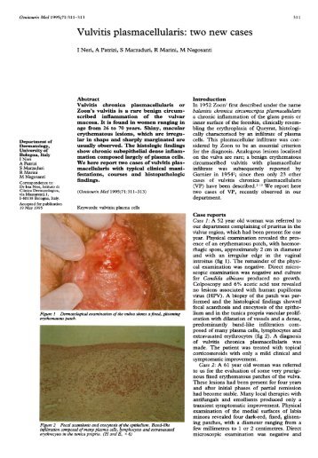 Vulvitis plasmacellularis: two new cases - ResearchGate