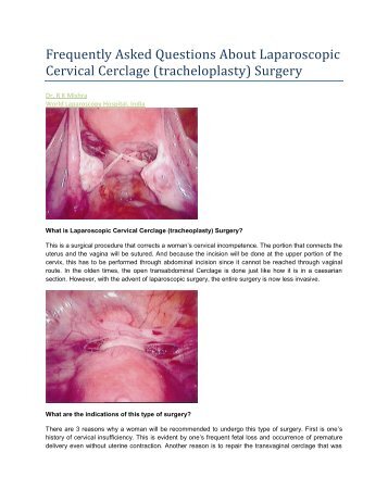 Cervical Cerclage - World Laparoscopy Hospital