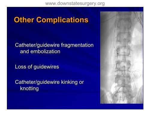 Complications of Central Venous Catheterization - Department of ...