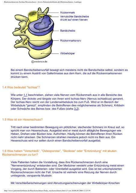 Rückenschmerzen (Ischias/Hexenschuss) - [www.Patientenleitlinien ...