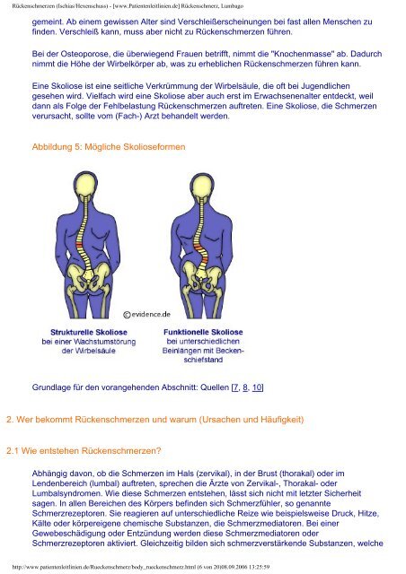 Rückenschmerzen (Ischias/Hexenschuss) - [www.Patientenleitlinien ...