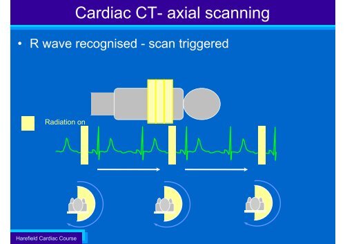 Technical Aspects of Cardiac CT - ImPACT CT Scanner Evaluation ...