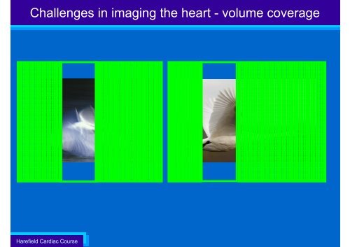 Technical Aspects of Cardiac CT - ImPACT CT Scanner Evaluation ...