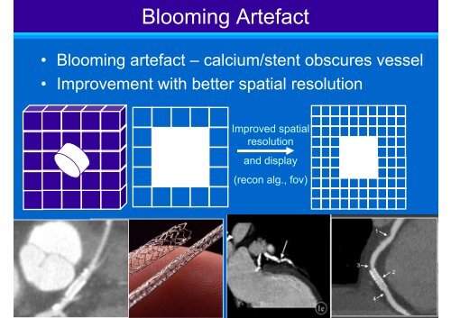 Technical Aspects of Cardiac CT - ImPACT CT Scanner Evaluation ...