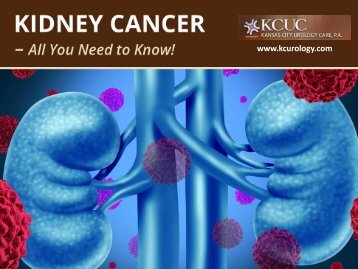 Cancer of the Kidney - What You Need to Know!
