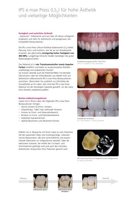 IPS e.max Press - Info Labor zum Zahnarzt - Ivoclar Vivadent