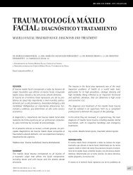 traumatologia-maxilofacial-10