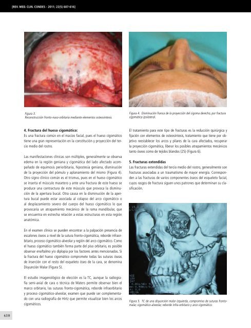 traumatologia-maxilofacial-10