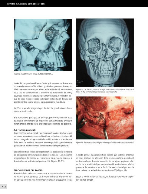 traumatologia-maxilofacial-10