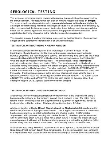 serological testing exercise 12 Name: exercise 12: serological testing: activity 1: using direct fluorescent antibody technique to test for chlamydia lab report pre-lab quiz results you scored 100% by answering 4 out of 4 questions correctly. serological testing exercise 12 Name: exercise 12: serological testing: activity 1: using direct fluorescent antibody technique to test for chlamydia lab report pre-lab quiz results you scored 100% by answering 4 out of 4 questions correctly.