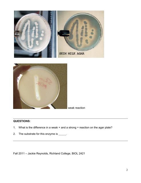 CASEIN HYDROLYSIS