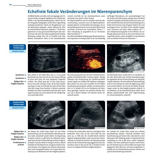 Fokale Veränderungen im Nierenparenchym: echofrei