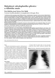OtevÅÃ­t - IntervenÄnÃ­ a akutnÃ­ kardiologie
