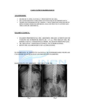 Tumor Fibroso Solitario - Instituto Nacional de Enfermedades ...