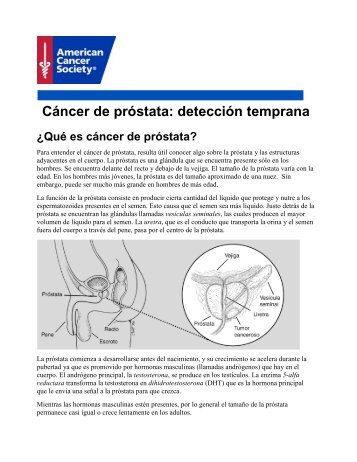 Cáncer de próstata: detección temprana - American Cancer Society