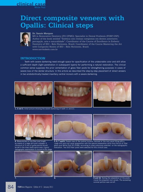 Clinical steps - FGM-Dental: Startseite