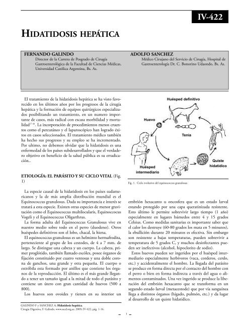 parásito cerebral sudamericano
