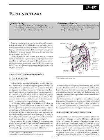 EsplenectomÃ­a. - sacd.org.ar