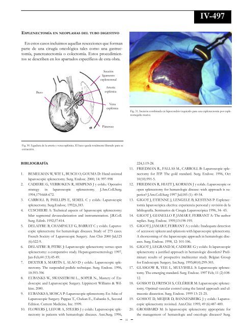 EsplenectomÃ­a. - sacd.org.ar