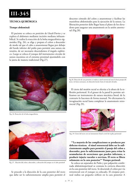 Megacolon. - sacd.org.ar