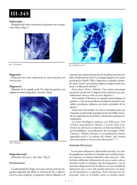 Megacolon. - sacd.org.ar