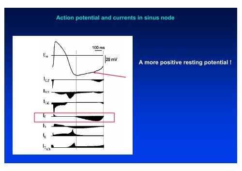 The action potential and the underlying ionic currents