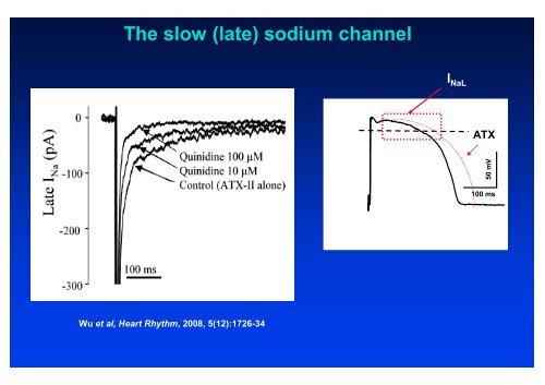 The action potential and the underlying ionic currents