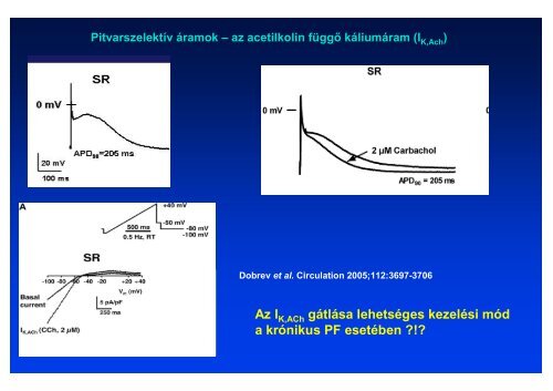 The action potential and the underlying ionic currents