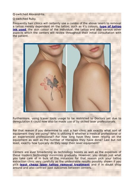 Tattoo Removal - Exactly What Is A Tattoo Removal Clinic?