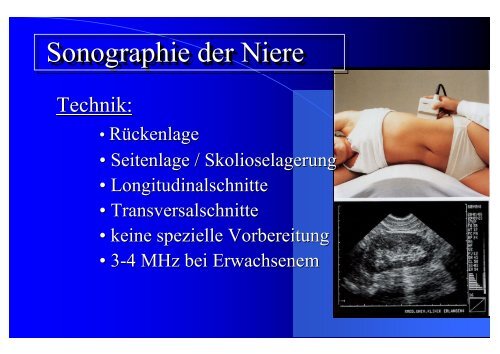 Sonographie der Niere Sonographie der Niere Sonographie der Niere