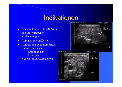 Vorlesung Hals + SD